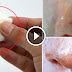 How To Get Rid Of Blackheads On Nose And Face!