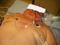 Skeptical Scalpel: Ultrasound-Guided Central Venous ...