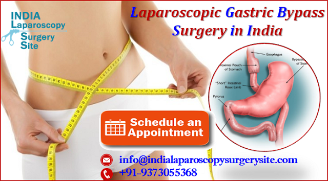 Affordable Cost Laparoscopic Gastric Bypass Surgery Propels Global Patients from all Nations 