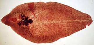 fasciola hepatica