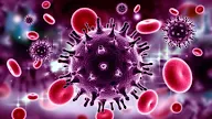 Penyebab dan Gejala HIV AIDS