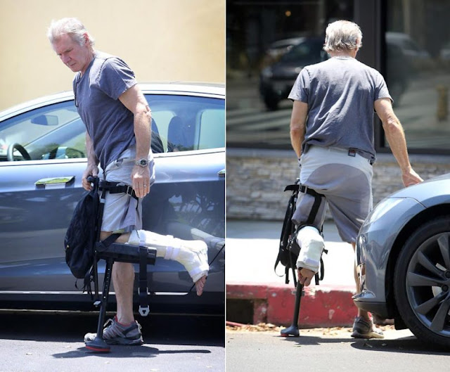 Harrison Ford's Injury During Filming of "Star Wars: The Force Awakens"