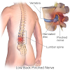 How much does Spine Surgery Cost ?