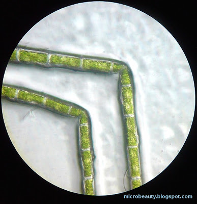 Algae under the microscope.