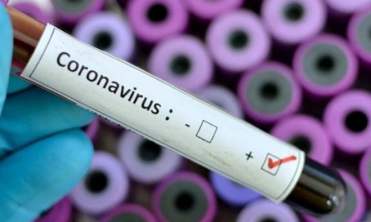 Vaksin untuk Mengatasi Virus Corona Siap Diuji Coba April 2020, naviri.org, Naviri Magazine, naviri