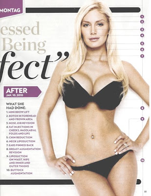 heidi montag surgery before after. heidi montag before and after