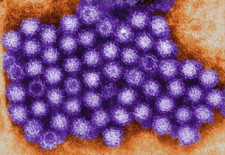 NOROVIRUS