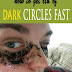 How To Get Rid Of Dark Circles Under Eyes Fast Best Remedies