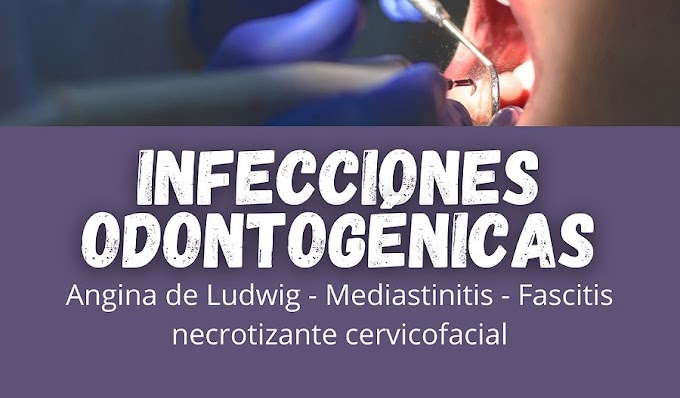 INFECCIONES ODONTOGÉNICAS: Complicaciones - Manifestaciones sistémicas