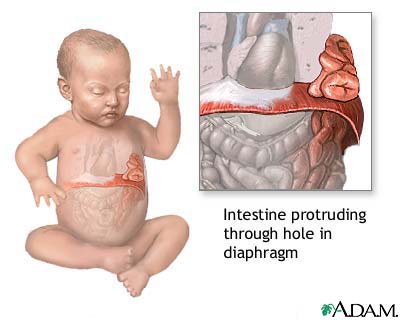 Diaphragm Of The Heart. diaphragm, the muscle that