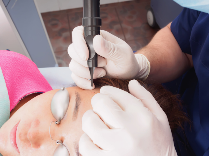 When should I consider laser treatment on my skin?