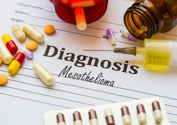 Finding a Mesothelioma Cancer Treatment Center - Help For Mesothelioma Patients