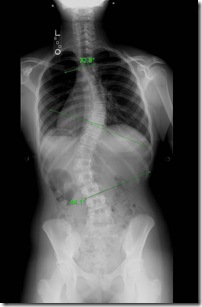 Logans x-rays before surgery-crop