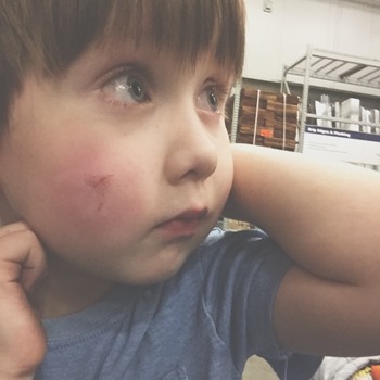 20161118 ames got hurt at lowes (6)