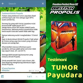 testimoni british propolis mengobati tumor payudara, kayu bajakah kalimantan asli