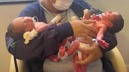 Dez meses depois de ter gêmeos, mulher dá à luz trigêmeos