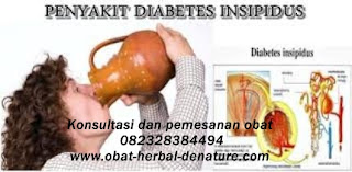 obat diabetes militus,obat herbal diabetes,obat diabetes herbal,cara mengobati diabetes secara herbal,pengobatan diabetes secara herbal,pengobatan diabetes tanpa resep dokter