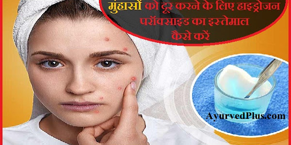 मुंहासों को दूर करने के लिए हाइड्रोजन परॉक्साइड का इस्तेमाल कैसे करें