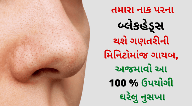 તમારા નાક પરના બ્લેકહેડ્સ થશે ગણતરીની મિનિટોમાંજ ગાયબ, અજમાવો બ્લેકહેડ રિમૂવ કરવાના ઉપાય અને ઘરેલુ નુસખા - blackheads removal on nose