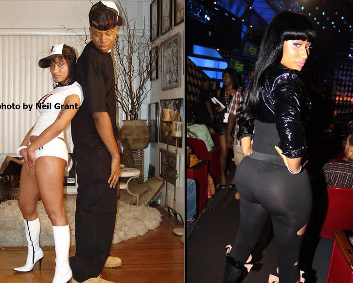 nicki minaj before and after plastic surgery pics. Alleged nicki minaj before;