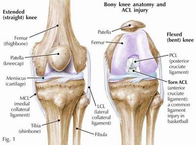 ACL Injuries