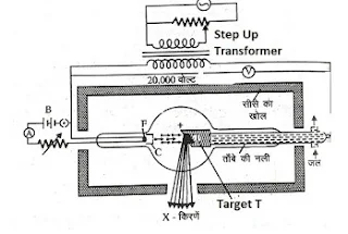 X-ray in hindi