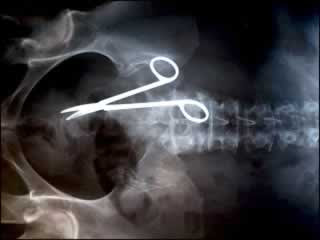 Unbelievable X-rays (12) 8