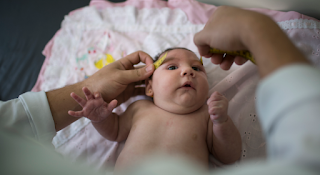 It causes babies to be born with small heads Scientists warn of the Zika virus  Scientists have warned that a single mutation in the already rapidly evolving Zika virus could lead to another major outbreak of the disease by evading existing immunity in humans.  This warning highlights fears that this virus could become a new pandemic virus to strike after the Corona pandemic.  Symptoms of the Zika virus In October 2015 an association between Zika virus infection and microcephaly was reported , and soon outbreaks broke out and evidence of transmission emerged throughout the Americas, Africa and other regions of the world. On February 1, 2016, the World Health Organization declared Zika infection an international emergency.  The new study, and full details of the Zika virus are in this report.  Zika virus can easily mutate to become more contagious Researchers at the La Jolla Institute of Immunology in California have found that the Zika virus can easily mutate to become more infectious with a single amino acid change.  And in a virus that is already showing signs of rapid evolution, scientists fear that this will allow the infection to spread more widely, according to their paper, published in the journal Cell Reports, and quoted by The Independent .  The scientists found that the dangerous mutation - called I39T / NS2B I39V - boosts the virus's ability to replicate in mice, mosquitoes and human cells.  Zika has many biological characteristics as the dengue virus, and prior exposure to dengue can provide protection against Zika. However, the researchers said that both viruses are rapidly mutating, and an advanced virus means that permanent protection cannot be guaranteed.  Head circumference in a child with alopecia  Zika can change its genetics "Dengue and Zika are RNA viruses, which means they can change their genome (genetic material)," said Professor Sujan Shrestha, who co-led the study with a team from the University of Texas Medical Branch.  "When there are a lot of mosquitoes and many human hosts, these viruses are constantly moving back and forth and evolving," he added.  The Zika virus, which is transmitted by mosquitoes, is usually mild in adults, yet it can infect a developing fetus; This leads to birth defects such as microcephaly, which causes a reduced head size and symptoms including stunted growth, seizures, and delayed speech skills.  In severe cases, it can cause fatal brain damage in children and miscarriage or stillbirth (a stillbirth after 28 weeks or more of gestation, according to UNICEF) in pregnant women, and its prevalence in the Americas in 2015 and 2016 caused global concern.  Also, in rare cases, the Zika virus can cause Guillain-Barré syndrome in adults, a serious nerve condition that causes problems such as numbness, weakness and pain.  “This single mutation is sufficient to enhance the virulence of Zika virus,” said Jose Angel Regla Nava, a former researcher at the La Jolla Institute of Immunology and current assistant professor at the University of Guadalajara, Mexico. disease, and cause a new outbreak.  Zika virus Zika virus is a genus of flaviviruses transmitted by mosquitoes, and was first detected in monkeys in Uganda in 1947, and then in humans in 1952 in the same country and the United Republic of Tanzania, according to the World Health Organization.  The organization adds that, "Outbreaks of Zika virus disease were recorded in Africa, the Americas, Asia and the Pacific, and during the period between the sixties and eighties, only rare and sporadic cases of human infection with this disease were detected across Africa and Asia, which were usually associated with mild illnesses. ".  Zika virus outbreaks The first recorded outbreak of Zika virus disease was reported in Yap (Federated States of Micronesia) in 2007, followed by another large outbreak of Zika virus disease in 2013 in French Polynesia and other countries and territories in the Pacific Ocean.  In March 2015, Brazil reported a large outbreak of rash, which was quickly identified as Zika virus infection and was considered in July 2015 to be caused by Guillain-Barré syndrome.  In October 2015, Brazil reported an association between Zika virus infection and microcephaly, and outbreaks quickly erupted and evidence emerged of transmission throughout the Americas, Africa and other regions of the world.  Symptoms of Zika virus The incubation period for Zika virus disease (the time from exposure to symptoms) is estimated to range from 3 to 14 days. Most people infected with Zika virus have no symptoms, and symptoms are usually mild and include:  -Fever -Skin rash -Conjunctivitis -Muscle pain -Arthritis -Feeling unwell -Headache How long do Zika symptoms last? Symptoms of Zika usually last for 2 to 7 days.  Complications from Zika virus disease Zika virus infection in pregnant women causes microcephaly and other congenital anomalies to the developing fetus, as well as other complications during pregnancy, such as fetal loss, stillbirths and premature birth.  Zika virus infection also causes Guillain-Barré syndrome, neuropathies and myelitis, especially in adults and older children, according to the WHO.  Zika virus transmission Zika virus infection is transmitted primarily by the bite of infected mosquitoes of the genus Aedes, especially Aedes aegypti, in tropical and subtropical regions.  The Aedes mosquito usually bites humans during the day and peaks in the early morning, late afternoon and evening hours, knowing that it is the same mosquito that transmits dengue, chikungunya and yellow fever.  Zika virus infection is also transmitted from mother to fetus during pregnancy, and through sexual intercourse, transfusions of blood and blood products, and organ transplants, according to the WHO.  Zika virus treatment There is no treatment available for Zika virus infection or the related diseases. Symptoms of infection are usually mild, and people with symptoms such as fever, rash or joint pain should get plenty of rest, keep fluids and treat pain and fever with common medications. If symptoms worsen, they should seek medical care and advice.  Pregnant women who live in areas with transmission of Zika virus infection or who develop symptoms of infection should seek medical attention for laboratory testing and other clinical care services, according to the WHO.  Prevention of Zika virus Protection from mosquito bites during the day and before evening is a key measure to prevent Zika virus infection, and special attention should be paid to protecting pregnant women, women of childbearing age and young children from mosquito bites, according to the World Health Organization.  Migraines and the Zika virus Microcephaly is a congenital malformation in which a child's head is smaller than the normal size, as it is in children of the same age and sex. A child with microcephaly often has a small brain, and may not develop and grow normally.  During pregnancy, the normal fetus’s head grows because its brain grows and enlarges, and in melasma, the head remains small because its brain did not develop normally during pregnancy, or because it stopped growing after birth.  It may occur alone or associated with other birth defects, according to the US Centers for Disease Control and Prevention.  A child with alopecia faces multiple problems that depend on the extent of the small head and the severity of the condition, including:  -Seizures. -Growth retardation; -Mental difficulties, such as decreased ability to learn. Problems with movement and balance. -Eating problems, such as swallowing difficulties. -Hearing loss. -Eyesight problems;  Alopecia treatment There is no cure for epilepsy, which is a permanent condition that accompanies the affected child until the end of his life, and treatments aim to help the child overcome previous complications.  In February 2016, the World Health Organization declared Zika infection an international public health emergency due to its association with thousands of fetal malformations (alopecia) in Brazil.  On February 8, 2016, Brazilian Health Minister Marcelo Castro told Reuters that Brazilian researchers are convinced that Zika is the cause of 3,700 confirmed or suspected cases of microcephaly in newborns in Brazil.  Guillain-Barré syndrome and Zika virus Guillain - Barré syndrome is a rare and dangerous condition that affects the peripheral nervous system, which includes nerves outside the brain and spinal cord, in which a person's immune system attacks parts of his nervous system.  Guillain-Barré syndrome symptoms Symptoms of the disease begin in the feet and legs before moving to the arms and legs, and include the following symptoms:  -Pain. -Numbness. -Increasing muscle weakness. -Problems coordinating movements, as the person is unable to walk without assistance. -Weakness affects both sides of the body and may get worse over several days.  Guillain-Barré syndrome treatment Treatment for Guillain-Barré syndrome depends on targeting antibodies produced by the immune system to prevent them from attacking the nervous system. Typically, most patients make a full recovery, and recovery may take weeks or months.  In some cases, the patient does not fully recover, and it is estimated that 20% of people with this syndrome suffer from muscle weakness after 3 years of illness, and complications may include problems with balance and sensation and the need for a wheelchair.  The World Health Organization says there is an increased risk that Zika virus infection may cause neurological complications in adults and children, including Guillain-Barré syndrome, neuropathies and myelitis.