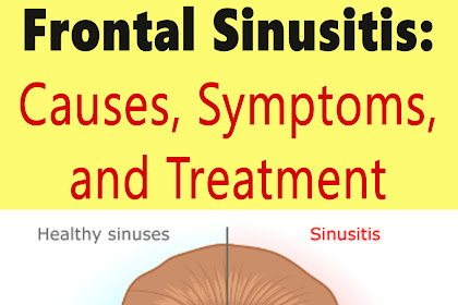 Frontal Sinusitis: Causes, Symptoms, and Treatment