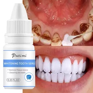 AD Teeth Whitening Essence Serum Oral Hygiene Deep Clean Whiten Tooth Remove Plaque Stains Fresh Breath Dental Bleaching Care Tools US $4.98 37 sold5 Free Shipping