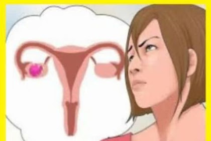 The starting list of Early Ovarian Cancer Symptoms