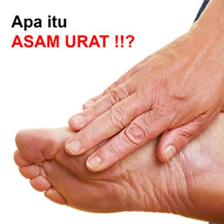 makanan penyebab asam urat dan rematik, asam urat dan gout, obat luar penyakit asam urat, cara menurunkan asam urat darah, mengatasi rasa nyeri asam urat, asam urat tanpa gejala, penyakit asam urat obat alami, ciri penyakit asam urat, tips obat asam urat alami, asam urat normal ukuran, obat generik asam urat yang aman, cara mengatasi penyakit asam urat secara alami, normal asam urat dan gula, obat generik asam urat yang aman, obat dokter untuk asam urat yang bagus, bolehkah penderita asam urat makan cincau, mengobati asam urat bengkak, asam urat menyerang usia muda, obat alami penghilang asam urat, obat asam urat dan bengkak, pemicu asam urat dan kolesterol, cara menyembuhkan penyakit asam urat dengan cara alami, sawi penyebab asam urat, ebook tentang asam urat, makanan yang mengurangi asam urat dan kolesterol, gejala asam urat di kaki, cara mengatasi penyakit asam urat, cek kolesterol cek asam urat, obat asam urat akut yang ampuh, asam urat ppt