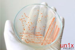Awas Bakteri Pemakan Daging Dapat Menginfeksi Tubuh Yang Luka