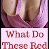 Did You Know What Do These Red Colored Dots On Your Skin Mean!