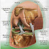 Lesiones de rodilla en el deporte