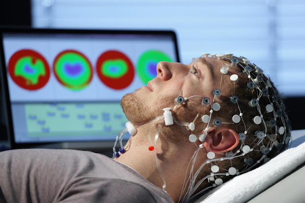 Electroencephalographs