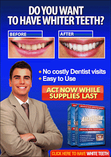 Alta White teeth whitening kit