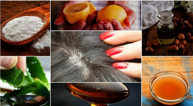 natural treatment for dandruff