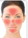 What Causes Redness in the Face - Best Way To Get Rid of Face Redness