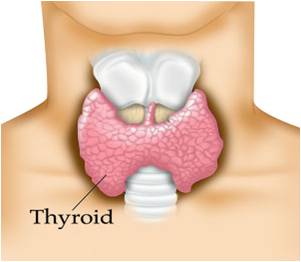 Connection Between Fertility Drugs and Thyroid Cancer