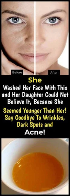 She Washed Her Face With This and Her Daughter Could Not Believe It, Because She Seemed Younger Than Her! Say Goodbye To Wrinkles, Dark Spots and Acne!