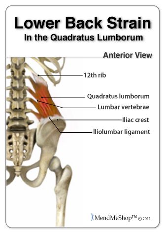 Pain in the Quadratus Lumborum Muscle