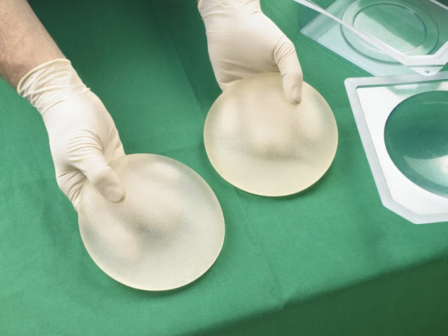 9 women’s deaths linked to silicone breast implants