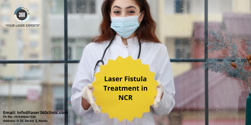 Laser Treatment