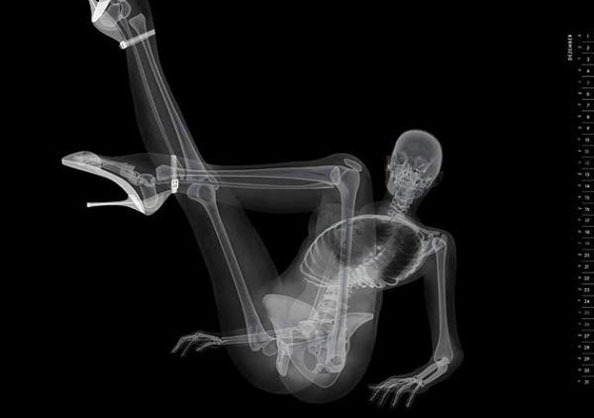 Pin Up X Ray. Wake up!