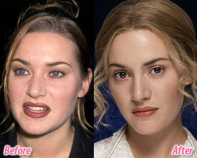 Celebs Before And After Nose