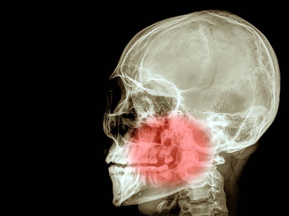 Occlusal Disease