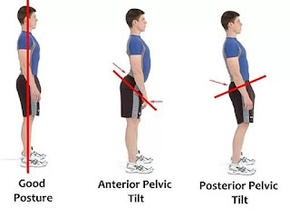 Anterior Pelvic Tilt