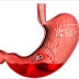 Hemorragia Digestiva: Causas Y Síntomas 
