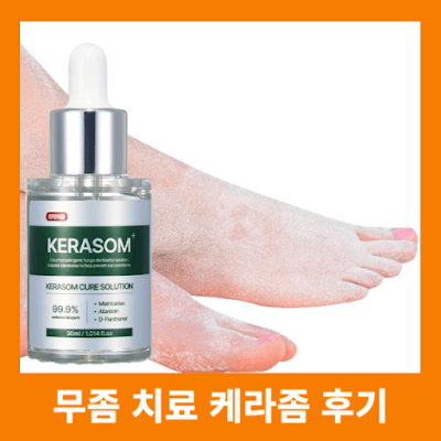 50대 무좀 고민 케라좀 큐어 솔루션으로 발톱 무좀 극복한 아버지의 생생한 후기